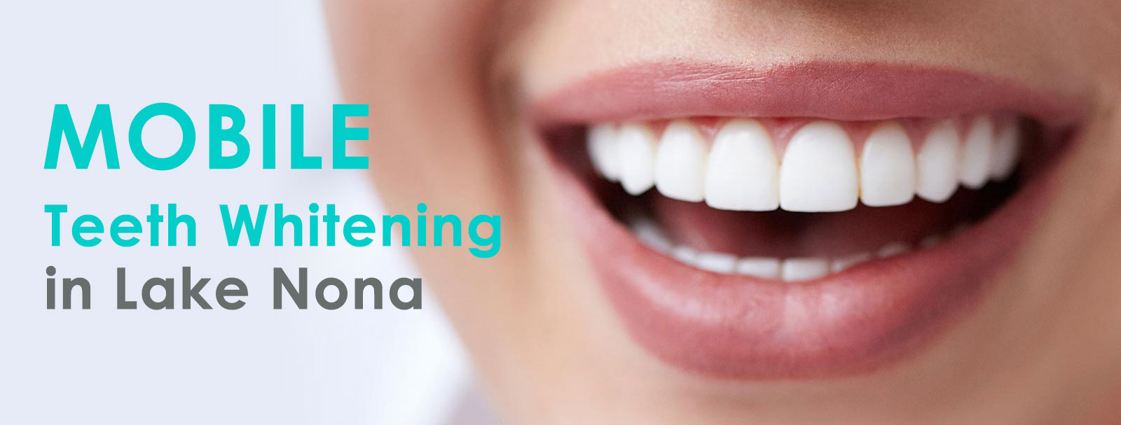 Mobile Teeth Whitening Lake Nona